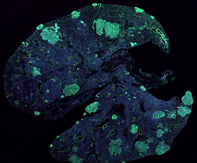 europapress 3358966 pulmon raton metastasis verde formado celulas cancerosas diseminan tumor