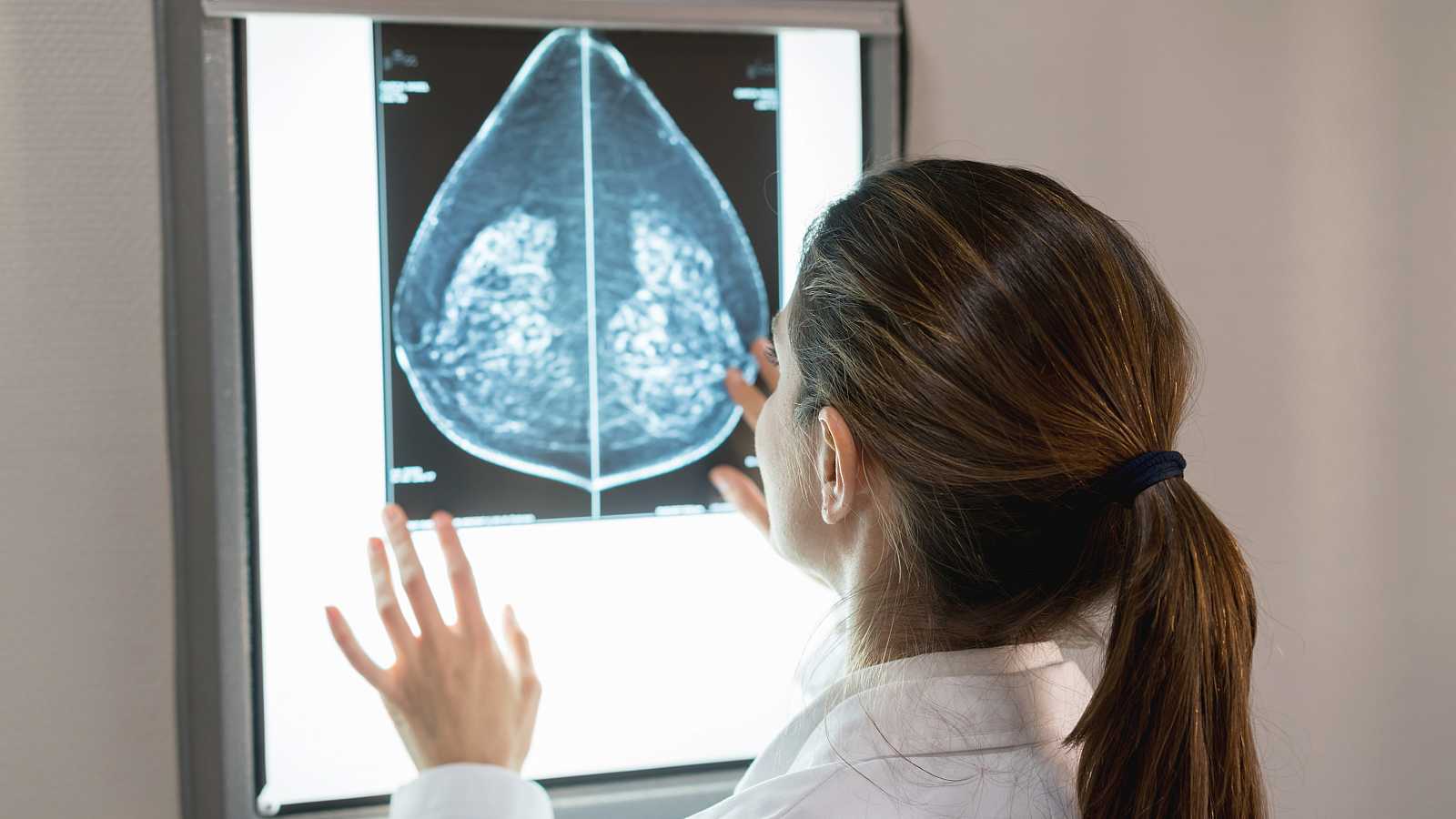 medico radiografia cancer mama